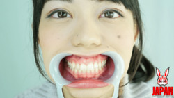 如果你能讓我看看櫻庭尿亞的嘴裡，她的牙齒。