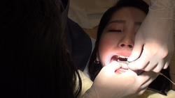 아마추어 마코토의 리얼 치과 치료 영상 (5 회째)