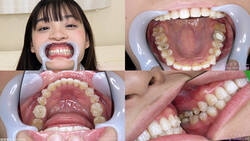 【치아 페티쉬】하나네 우라라의 치아를 관찰했습니다!