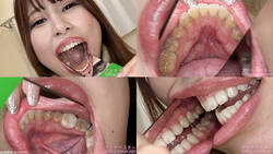 【치아 페티쉬】아리오카 미짱의 치아를 관찰했습니다!