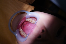 Dental Treatment ; Amateur Girl MEGUMI (25)  (1st Time)