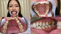 【치아 페티쉬】니노미야 카즈카의 이빨을 관찰했습니다!