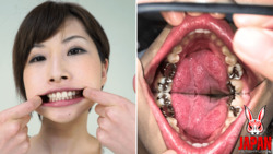 Teeth Inspection Chronicles: Dive into Yume Hidaka's Enigmatic Oral Realm