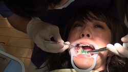 素人るみさんの歯科治療映像（２回目）