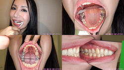 我們觀察到牙齒 [牙科戀物癖] 真正的薩拉 · 布蘭得利 ！
