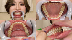 【歯フェチ】ERINAちゃんの歯を観察しました！