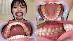 [Tooth fetish] I observed Suzu Monami&#39;s teeth!