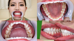 【歯フェチ】永井マリアちゃんの歯を観察しました！