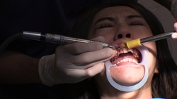 素人るみさん（３４）のリアル歯科治療映像（１回目）