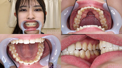 [Tooth fetish] I observed Miyu Morioka&#39;s teeth!