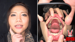 Subjective! Gal girl Rena Kitamura dedicated to inlay tooth fetish maniacs