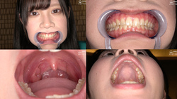 &quot;I observed new model Emma&#39;s teeth, mouth, and tongue tongue&quot; Emma Nishioka ⑩